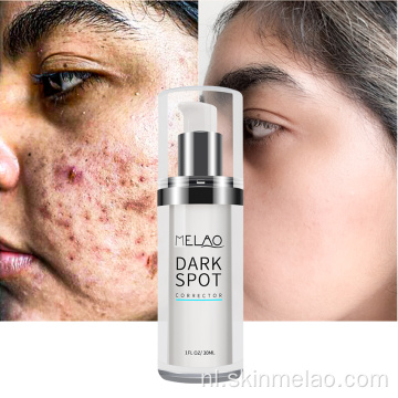 Dark Spot Corrector Serum